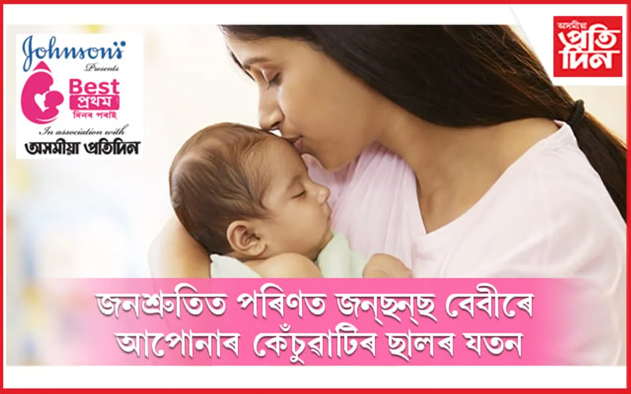 জনশ্ৰুতিত পৰিণত জনছনছ বেবীৰে আপোনাৰ কেঁচুৱাটিৰ ছালৰ যতন